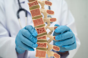 Osteoporosis After 60:  How You Can Protect Your Bones and Stay Active Image